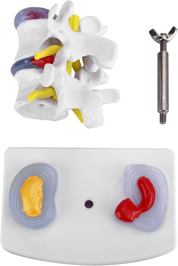 YUYTE Human Spine Model, Human Anatomical Lumbar Disc Herniation Model Human Spine School Training Supplies Excellent Way for Demonstrating Disc, The Details of The Human Spine