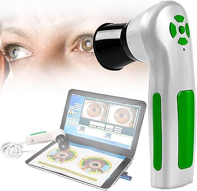 12 MP Auto Focus Iris Detector,Iris Analysis Camera,High Resolution 4032  3024 Iriscope Diagnostic Eye Camera with HD 30x Iris Lens and Driver-Free Analysis Software