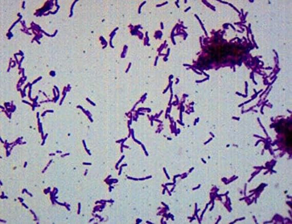 EISCO Bacillus Smear, Gram Negative Stain - Prepared Microscope Slide - 75 x 25mm - Biology & Microscopy